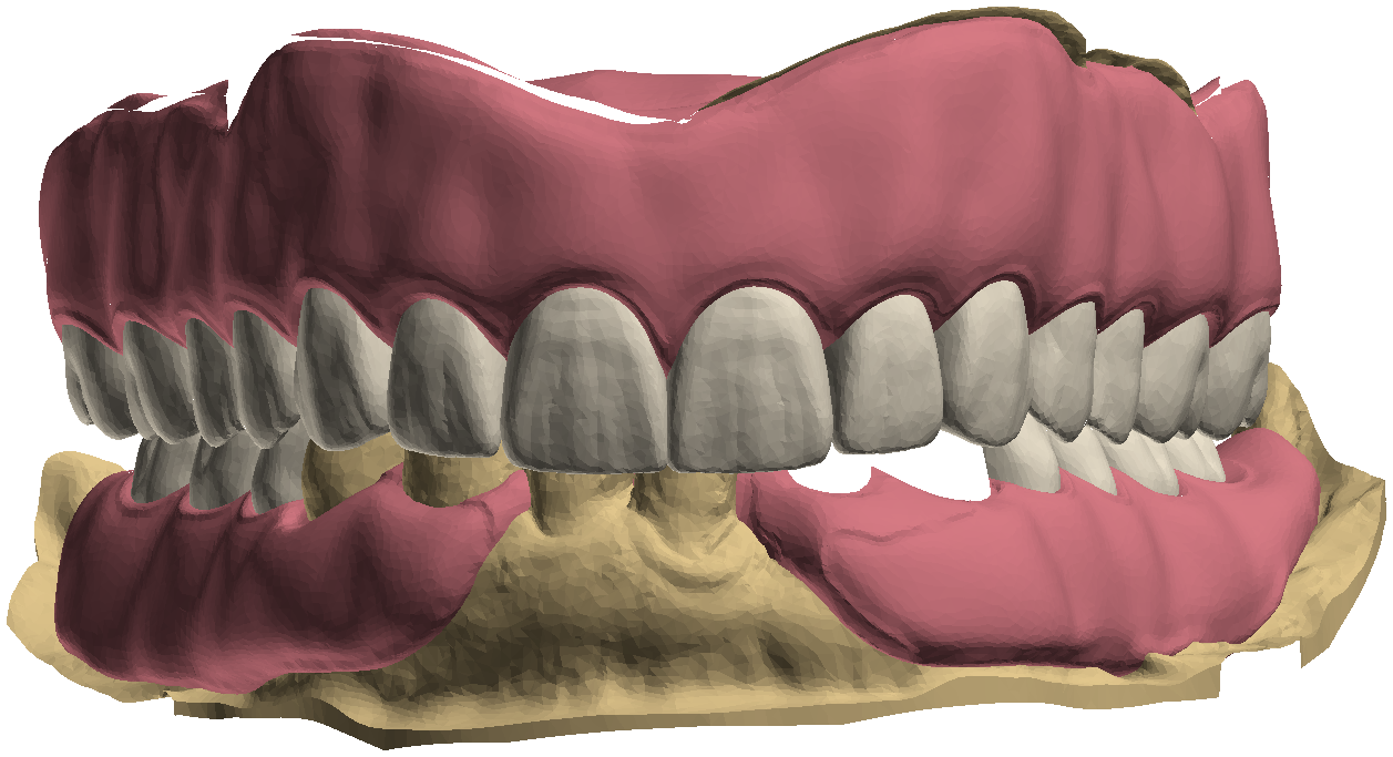 Frontal