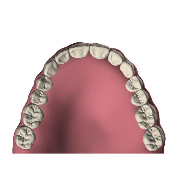 Occlusal